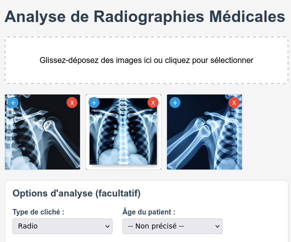 Illustration analyse radiologique par intelligence artificielle